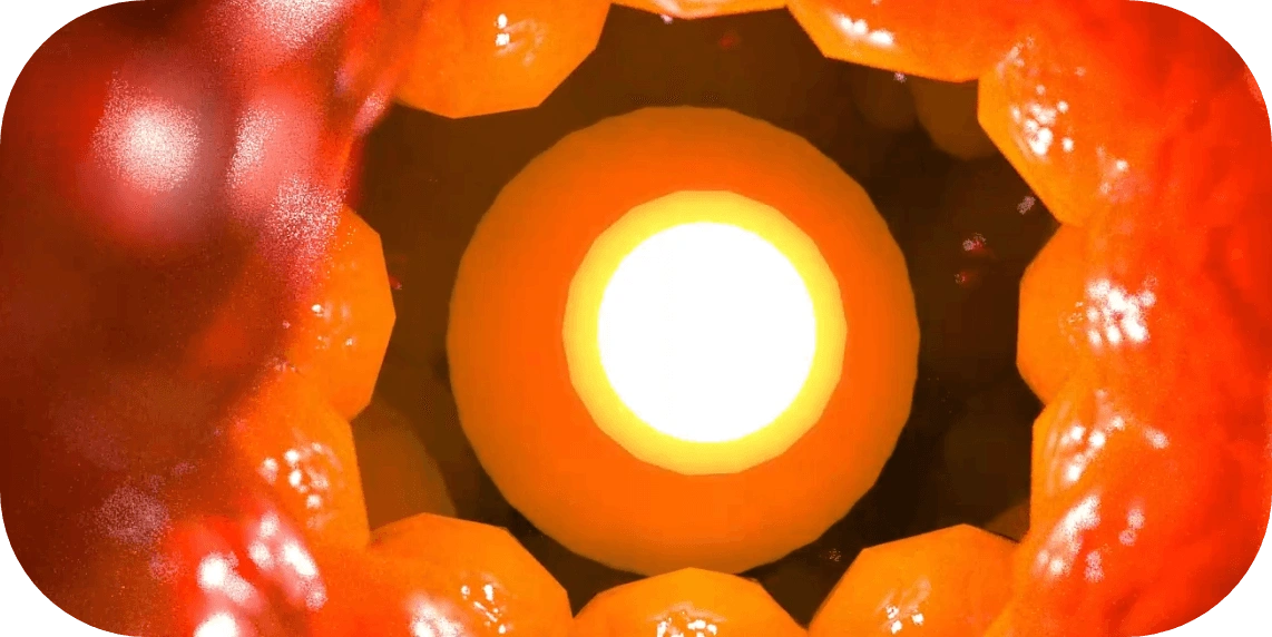 EndoliftX laser activation process that tightens skin and collagen stimulates