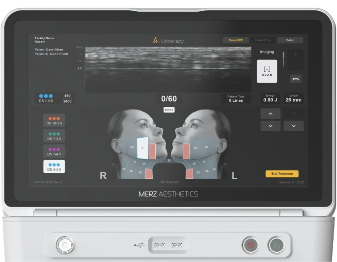 Ultherapy Prime real-time ultrasound imaging screen